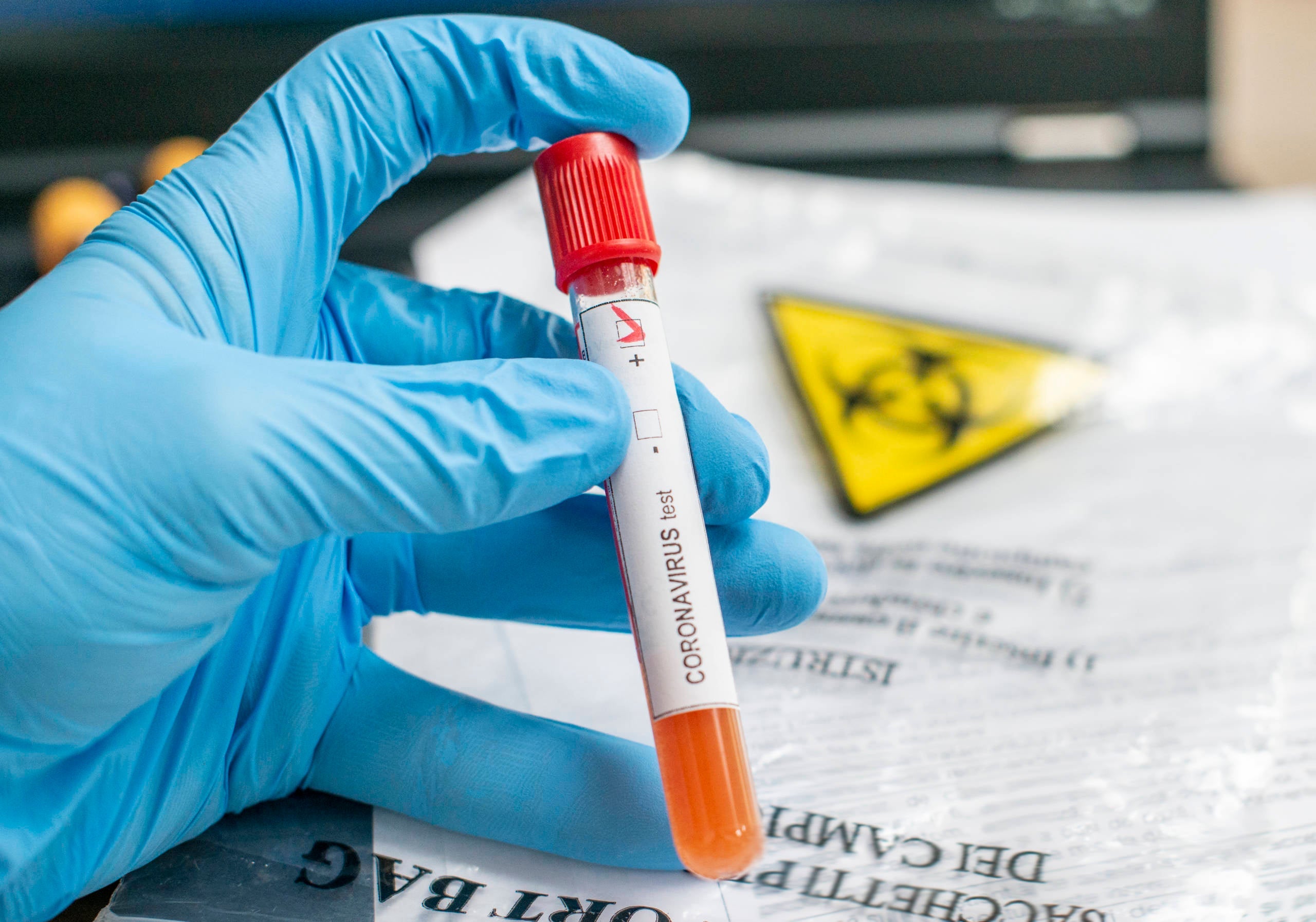 Close up of microbiologist hand with surgical gloves holding a blood test tube for coronavirus. Test tubes with blood sample for covid-19 virus, biohazard transportation bag