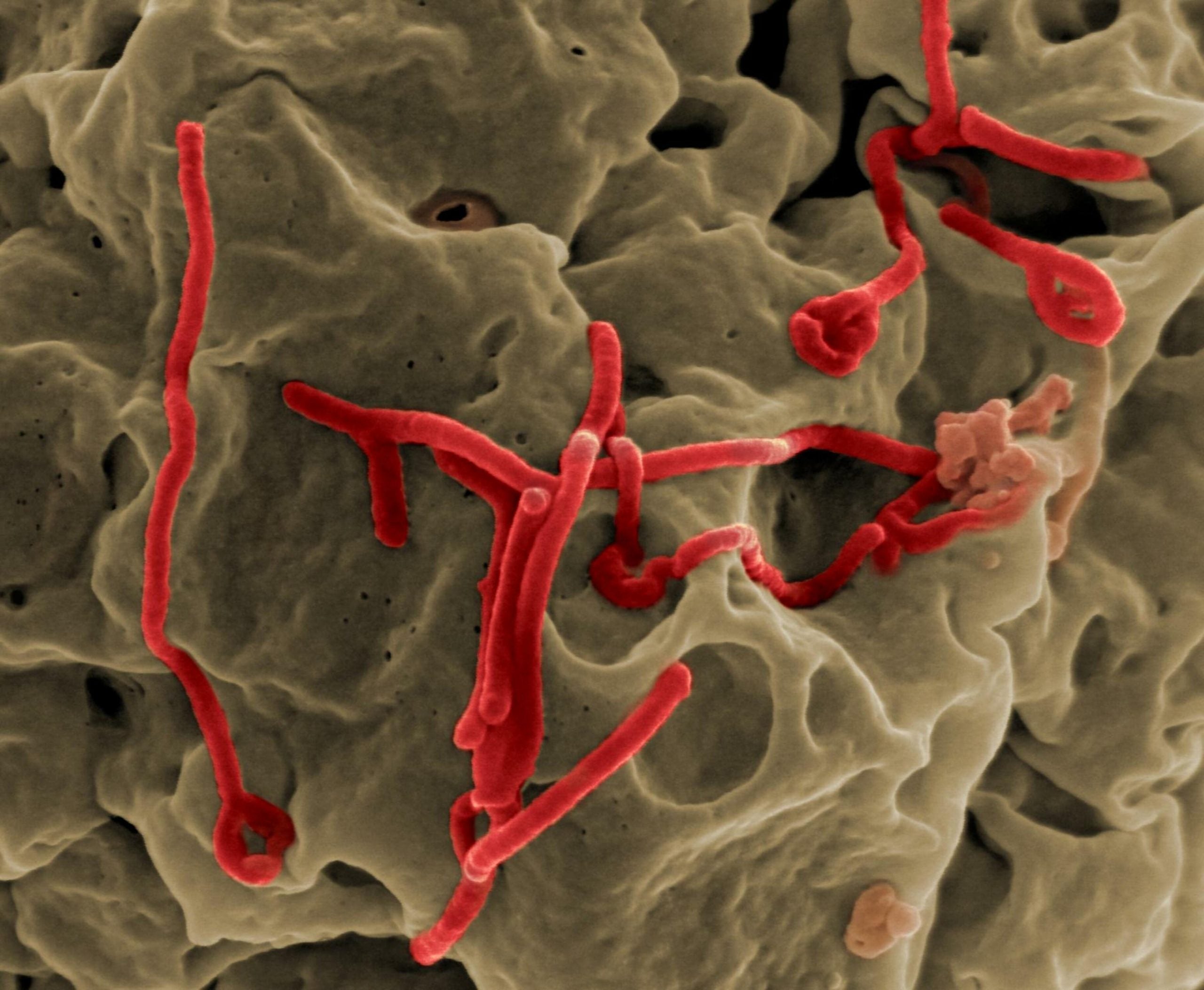 Ebola virus